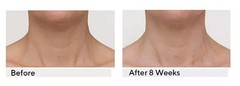 Strivectin TL advanced Neck Tightening Cream Plus with NIA114, 1oz, NEW W/O box