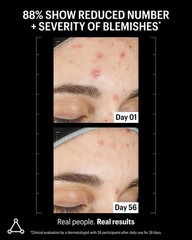 Allies of Skin Azelaic Kojic Clarifying Face Serum | Clinically Proven for A…