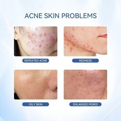 Dr. Leo Acne Essence – Salicylic Acid Serum for Acne & Scars NEW