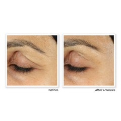 PURE RETINOL VITAMIN A 2.5% + HYALURONIC ACID HA – RETINOL WRINKLE CREAM / SERUM
