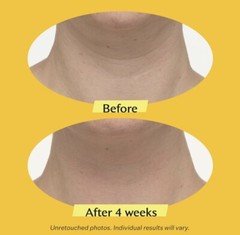 StriVectin TL ADVANCED TIGHTENING NECK CREAM Plus W/NIA-114 1 oz/ 30 ml