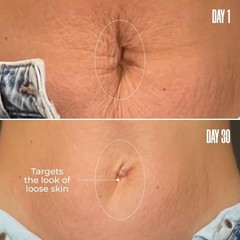 MAËLYS Assorted Cosmetics B-FLAT Belly Firming Lotion – Stretch Mark Sizes