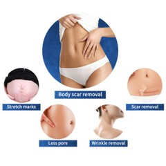 2 Handles RF Fractional Cold Hammer Machine Skin Wrinkle Stretch Marks Removal
