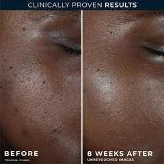 Even Tone + Lift Moisturizing Night Cream, (New Look, Same Formula), anti Aging,