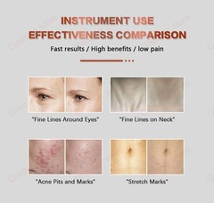 2in1 Fractional RF Machine 10/25/64/nano Cartridge Head Wrinkle Acne Removal