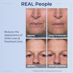 Plexaderm Rapid Reduction Eye Serum – Visibly Reduces Under-Eye Bags, Wrinkles~