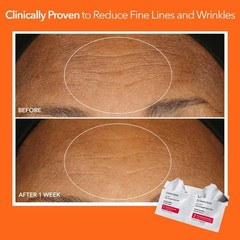 Extra Strength Daily Peel Pads – 2-Step Exfoliating Treatment for Anti-Aging, Sm