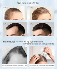 Bio Needle Derma Stamp Microneedling Tool Adjustable Needle For Body Hair Growth