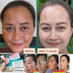 1 SET KIMCHI (EXP: 10/25,01/26) FACECREAM 30 DAYS PLUS + SUN SCREEN SPF50 PA+++