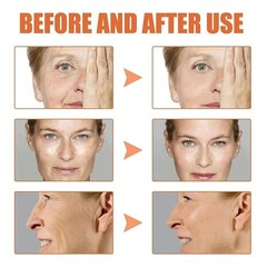 3pcs Face Serum: Stock Solution Facial Serum Suitable for All Skin