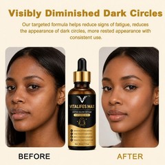 Vitalifes Max Skin Protect Serum for Gentle Facial Skin Care & Extra Glow 30ml