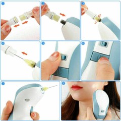 10-100PCS Tips For Eyelid Lift Fibroblast Plasma Pen / 4TH Generation Plasma Pen