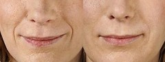 Argireline Anti-Expression Line/Crease Serum+M 3000,SNAP-8, SYN-AKE, Syn-Coll