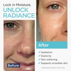 Hyaluronic Acid for Skin – 100% Pure Medical Quality Strength Formula 8 Oz