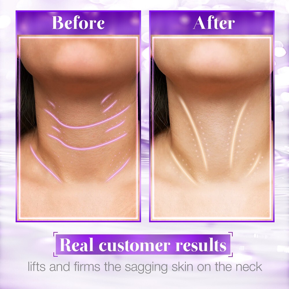 Firming Neck Cream 50g – Anti-Wrinkle Peptide Collagen Tightens Loose Neck Skin