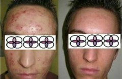 10-20-30-40-50-60-70% Glycolic Acid Night Cream 2oz/ 60ml Aging/Acne/scar