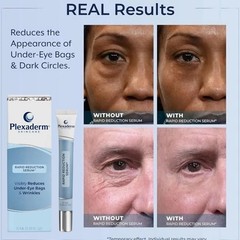 Plexaderm Rapid Reduction Eye Serum, Visibly Reduces Under-Eye Bags & Wrinkles