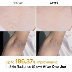 Dr. Melaxin Peel Shot Exfoliant Kojic Acid Turmeric Spray 200ml Brand new