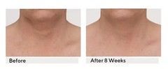 Strivectin TL advanced Neck Tightening Cream Plus with NIA114, 1oz, NEW W/O box