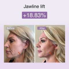 M1 4-In-1 Facial Toning Tool with Multi-Leading Tech for a Visibly Radiant & You
