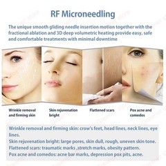 2in1 Fractional RF Machine 10/25/64/nano Cartridge Head Wrinkle Acne Removal