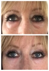 No.1 Instant Wrinkle Serum- 5 STAR REVIEWS- IT WORKS A+- REPEAT CUSTOMERS!