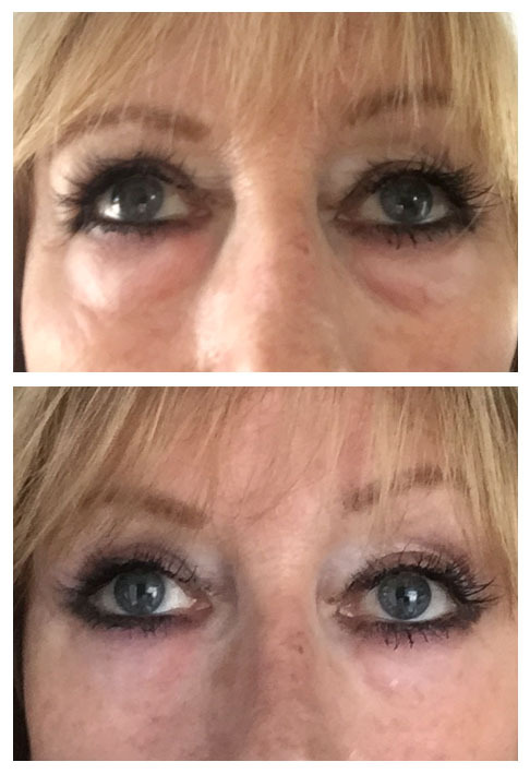 No.1 Instant Wrinkle Serum- 5 STAR REVIEWS- FACE DEFINE- QUICK SHIPPING