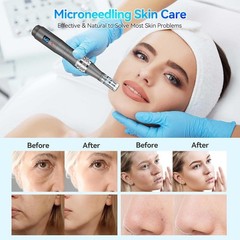 Electric Micro Needle Pen Professional Microneedling Pen Anti-Aging Skin Care M8