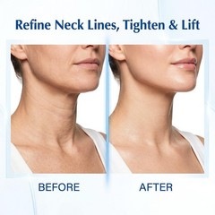 5PCS Magec Collagen Fullerene Neck Cream – Neck Skincare with Collagen