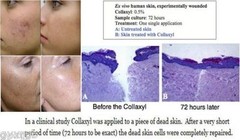 32 oz. SCAR FADE WRINKLE REDUCE HYALURONIC ACID SERUM WITH ACTIVE PEPTIDES
