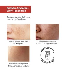 Vitamin C 10% Serum – Brightening Skincare | Perfect Brightening Serum | 30ml