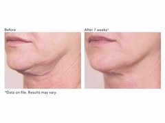 Revision Skincare Nectifirm Cream 1.7oz – 11053361 Free Ship