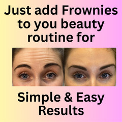 Frownies Facial Patches for Forehead and Between Eyes