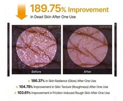 Dr. Melaxin Peel Shot Exfoliant Kojic Acid Turmeric Spray 200ml NEW