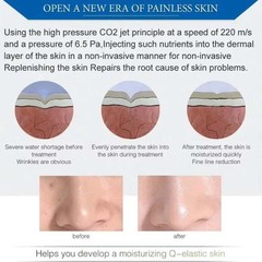 Professional Frozen Gun Manual Facial Skin Lift Skin Rejuvenation Machine