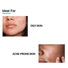 Fixderma 2% Salicylic Acid Serum for Anti Acne & Spot Treatment Oily Skin 15gm