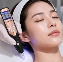 Cold Plasma Pen for Acne Treatment, Anti-Inflammation & Skin Rejuvenation