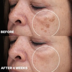 CITYGOO Dark Spot Remover for Face: Dark Spot Corrector Cream – Enriching Skin