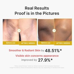 Kojic Acid & Turmeric Body Peel Shot for Brightening & Exfoliating 9.46 Fl.Oz