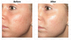VITAMIN C 30% Facial Serum + HYALURONIC ACID + FERULIC ACID Anti-Aging Gel Cream