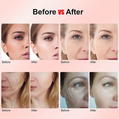 Multi-Functional Anti-Aging Machine Home Beauty Care Equipment Facial Massager