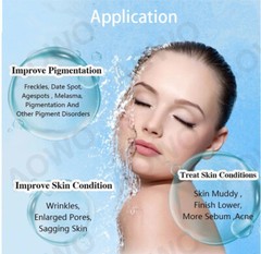 5-100pc 5 Pin Crystal Multi-Tips Replace Needle For Beauty Facial Skin Care Tool