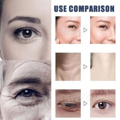 Enhanced 6Pcs Polypeptide Collagen Elastic Essence Cream Anti-Wrinkle Micro-Mole