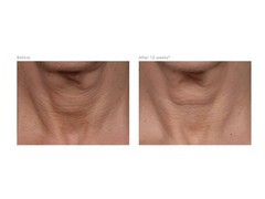 Revision Skincare Nectifirm Cream 1.7oz – 11053361 Free Ship