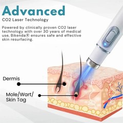 Rechargeable Electric Plasma Pen Mole Wart Skin Tag Remover for Face Body