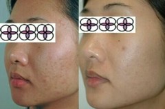 10-20-30-40-50-60-70% Glycolic Acid Night Cream 2oz/ 60ml Aging/Acne/scar