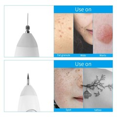 Replace Small/Big Thick Tips For Laser Skin Dark Spot Tattoo Removal Plasma Pen