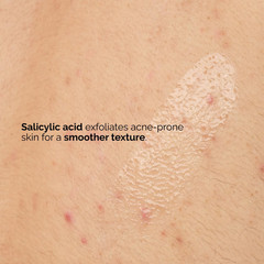 The Ordinary Salicylic Acid 0.5% Body Serum, Exfoliating Treatment for Acne-Pron