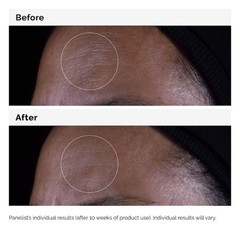 The Ordinary Authentic Serum for Visible Skin Repair and Wrinkles 1 oz / 30 mL
