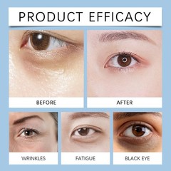 2Pack Firming Eye Serum for Rapid Reduces Under-Eye Bags, Wrinkles, Dark Circles